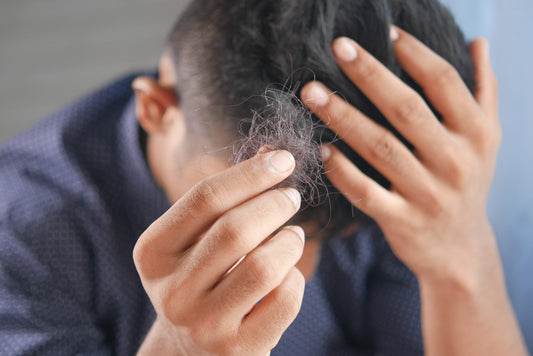 8 Causes of Hair Loss in Men